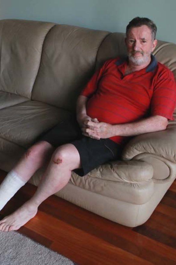 "I instantly thought, 'I'll never survive this'"... Allan Baillie.