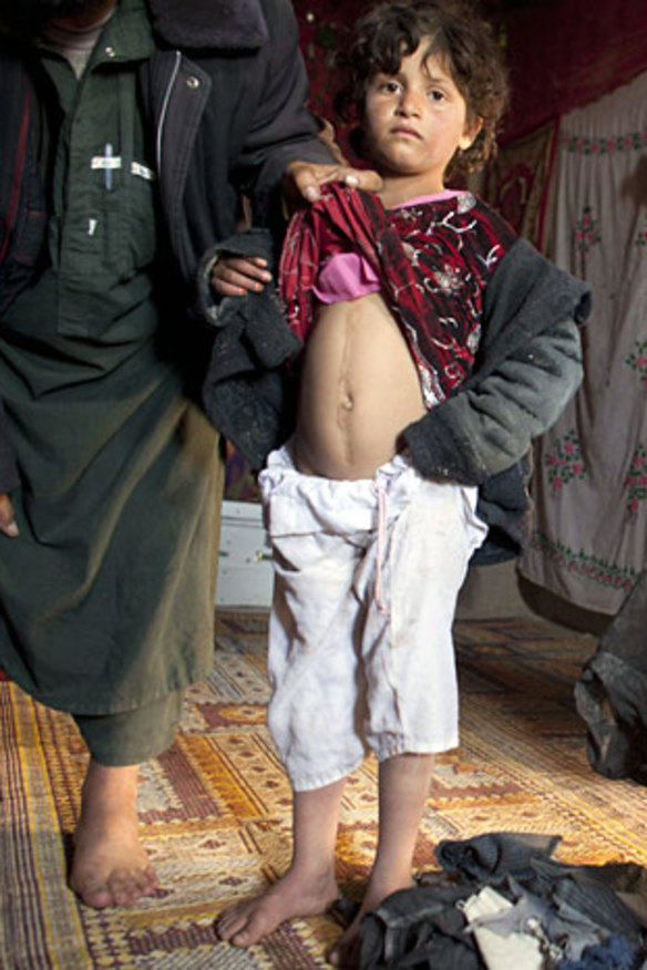 One of Amrullah Khan's daughters, who was injured in the raid.