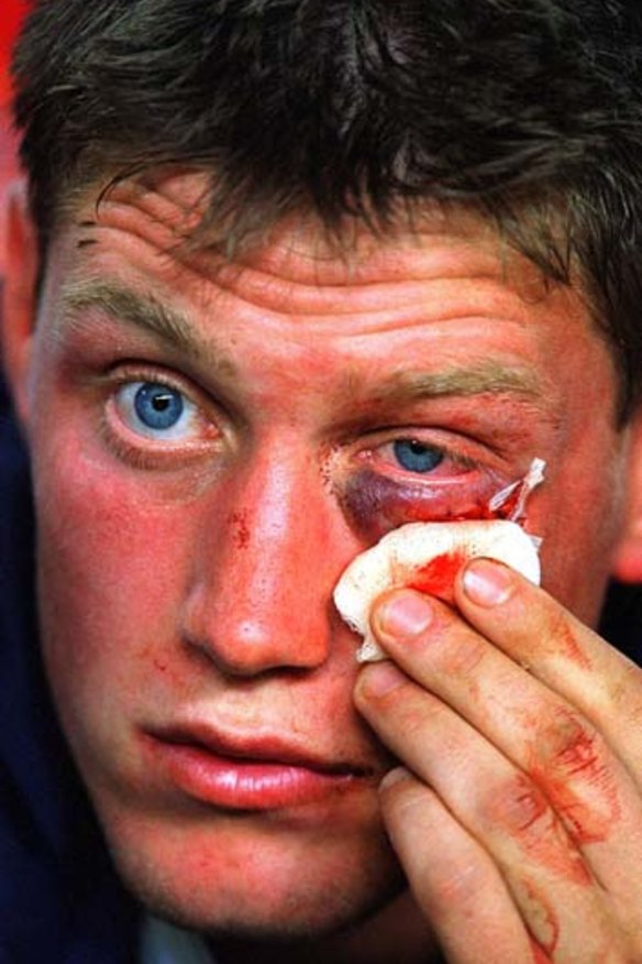 War-wound ... Ronan O'Gara of the British Lions looks on from the bench after receiving eight stitches.