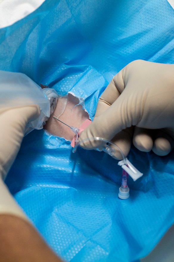 20 to 1: New hospital program reduces number of failed IV insertion ...