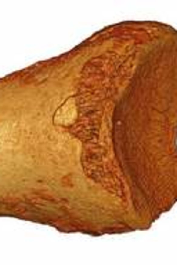 Neanderthal toe points to history of incest