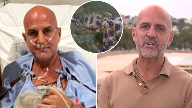 A Sydney man is lucky to be alive after being bitten by a poisonous blue-ringed octopus at Balmoral Beach.