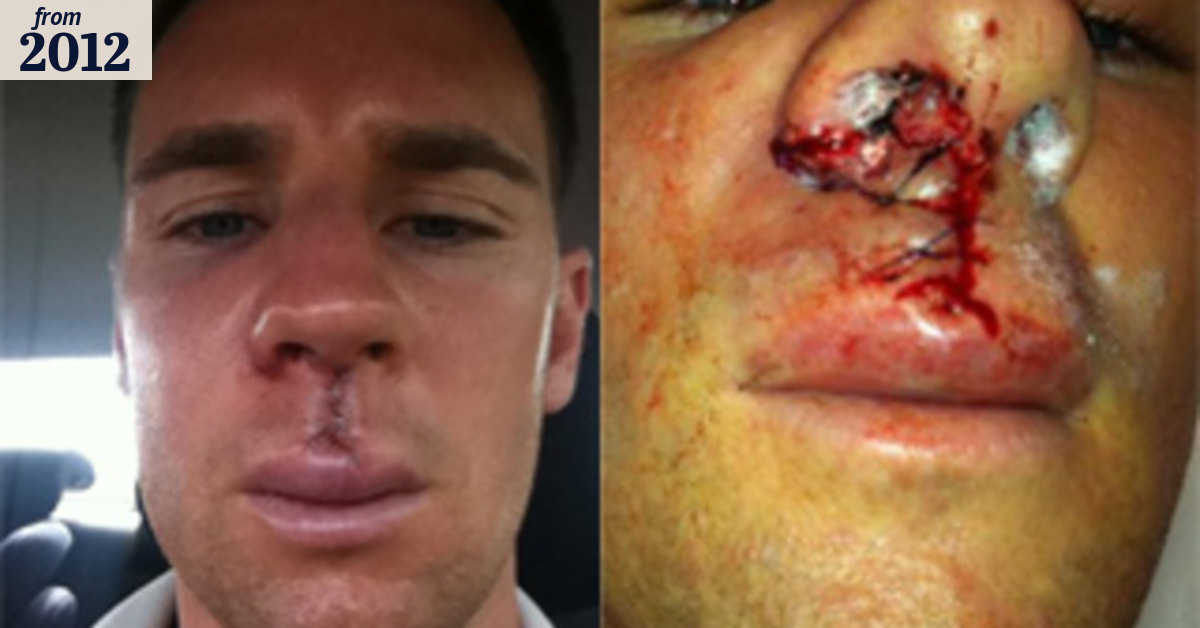 Battered Smeltz on the mend after his 'hardest game'