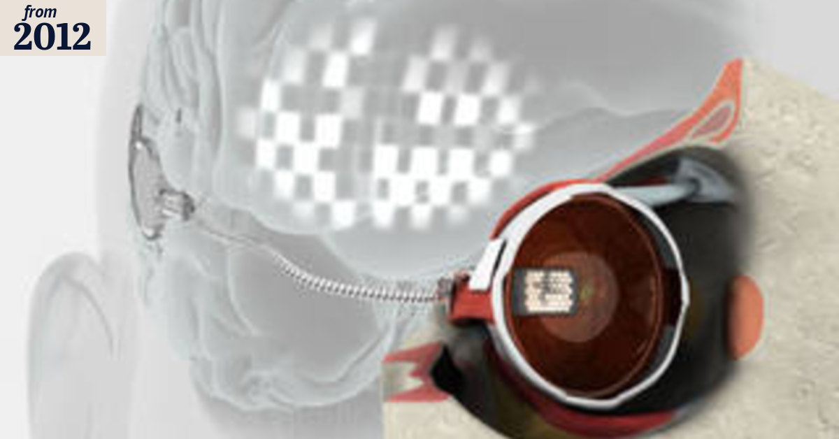 Scientists facing a $2m shortfall on bionic eye project