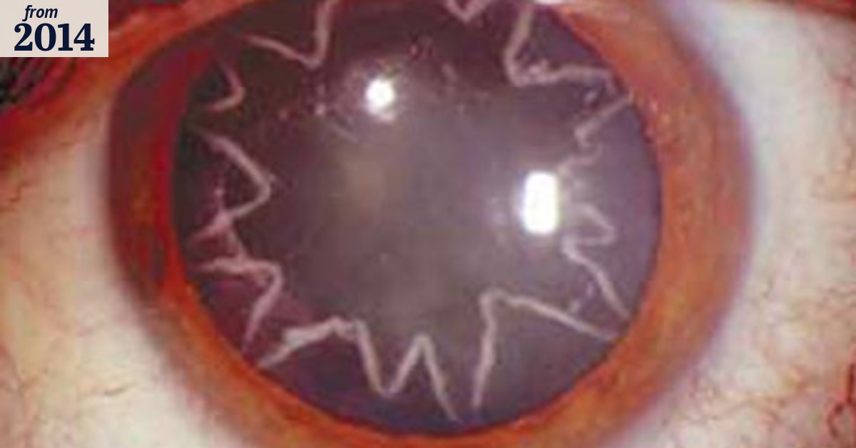 Stars form in electrician's eyes after powerful shock