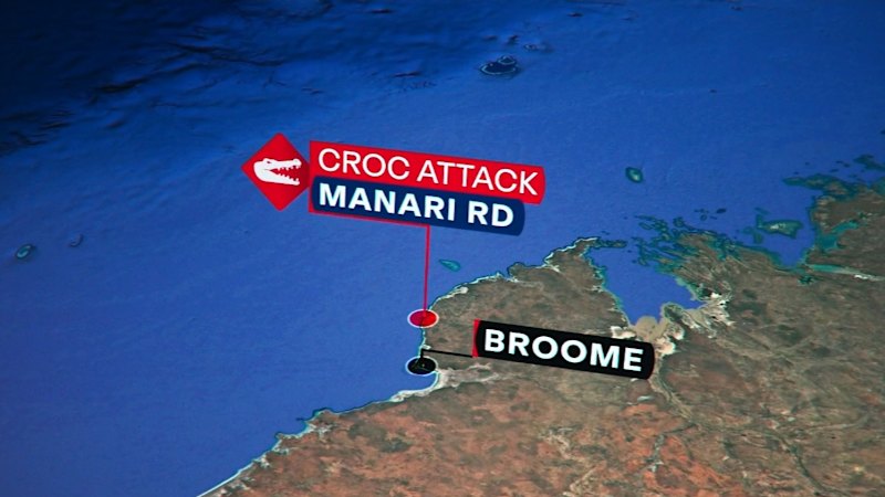 Man attacked by crocodile in northern WA flown to Perth for surgery