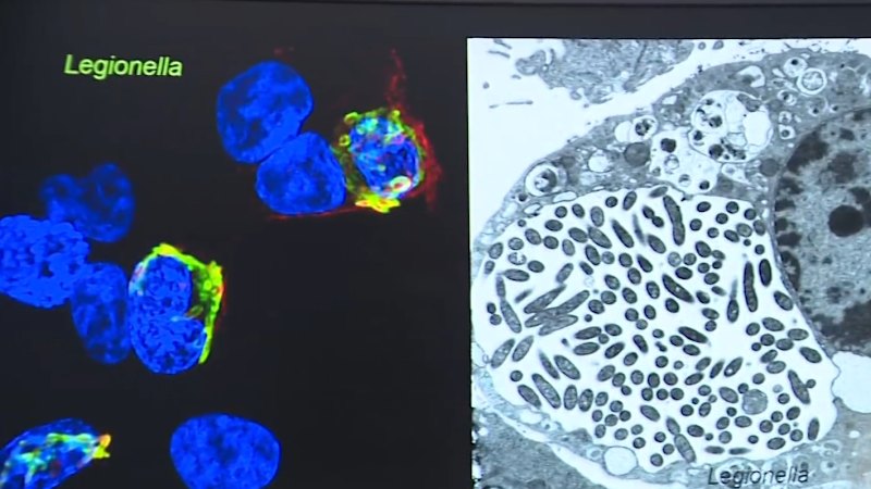 Legionnaires' disease outbreak reported in Melbourne's north