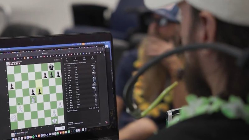 First UK patients trial Elon Musk's Neuralink