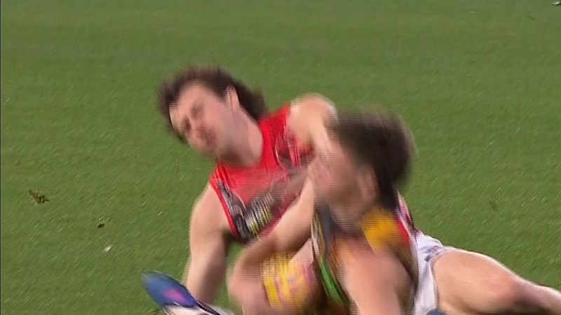 Essendon skipper cops suspected broken jaw