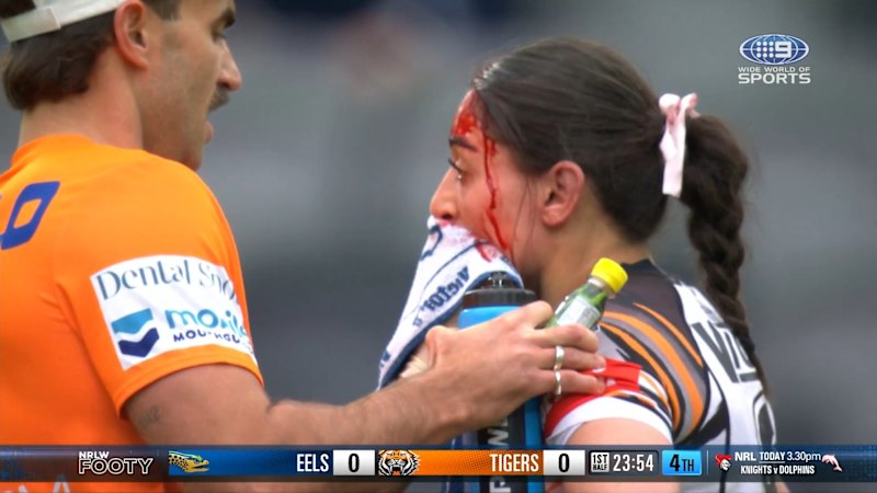 Tigers hooker bloodied after head clash