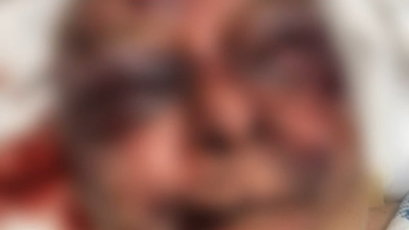 Man charged over assaulting dementia patient at aged care facility