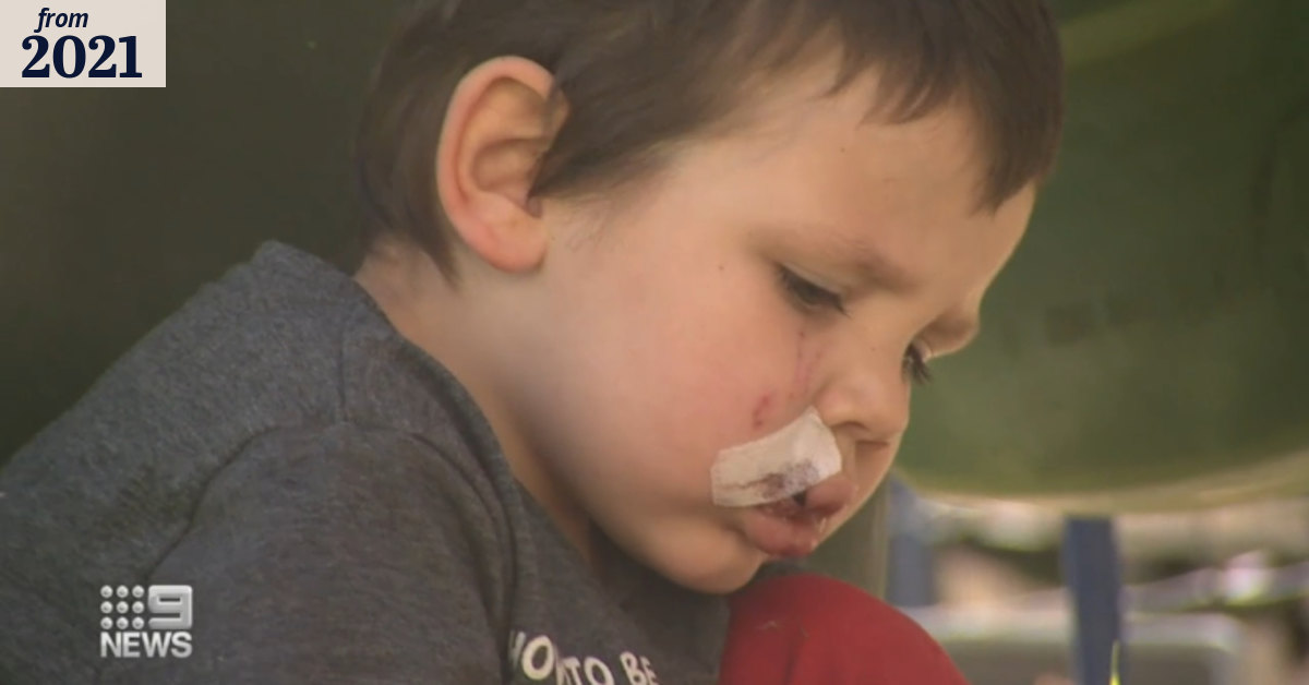 SA boy recovering after dog attack