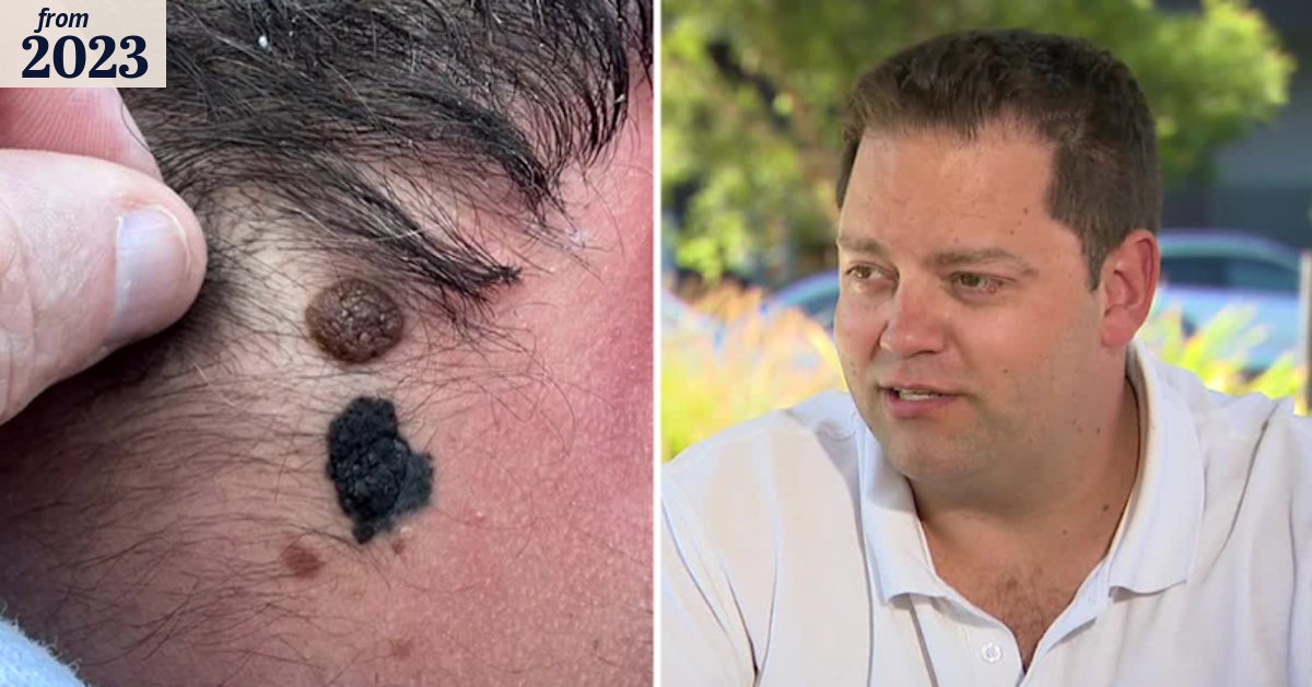 Homeowner saves tradie's life after spotting suspicious mole