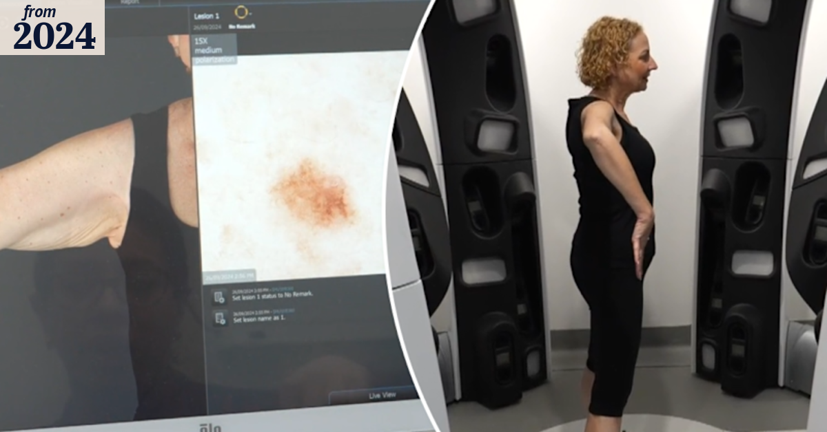 Skin cancer screening research receives $10 million boost