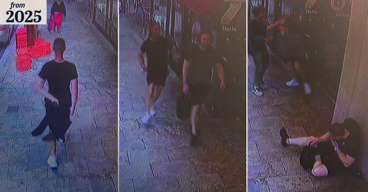 Man’s jaw broken in alleged random attack