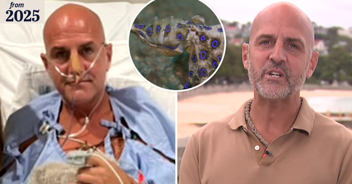 Man recounts moment blue-ringed octopus bit him