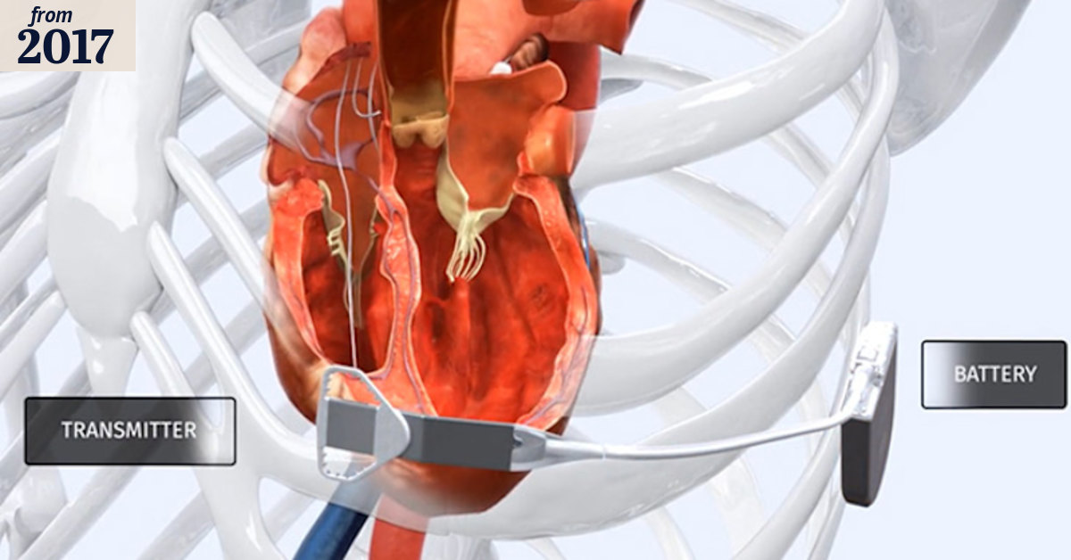 How the WiSE-CRT wireless pacemaker works